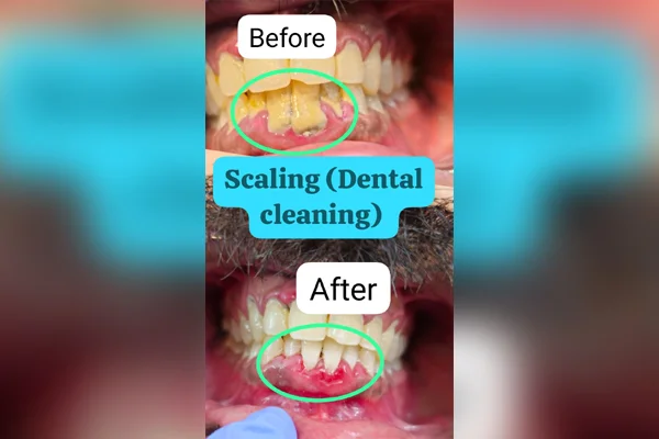 Scaling