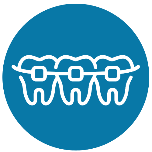 Orthdontic Treatment
